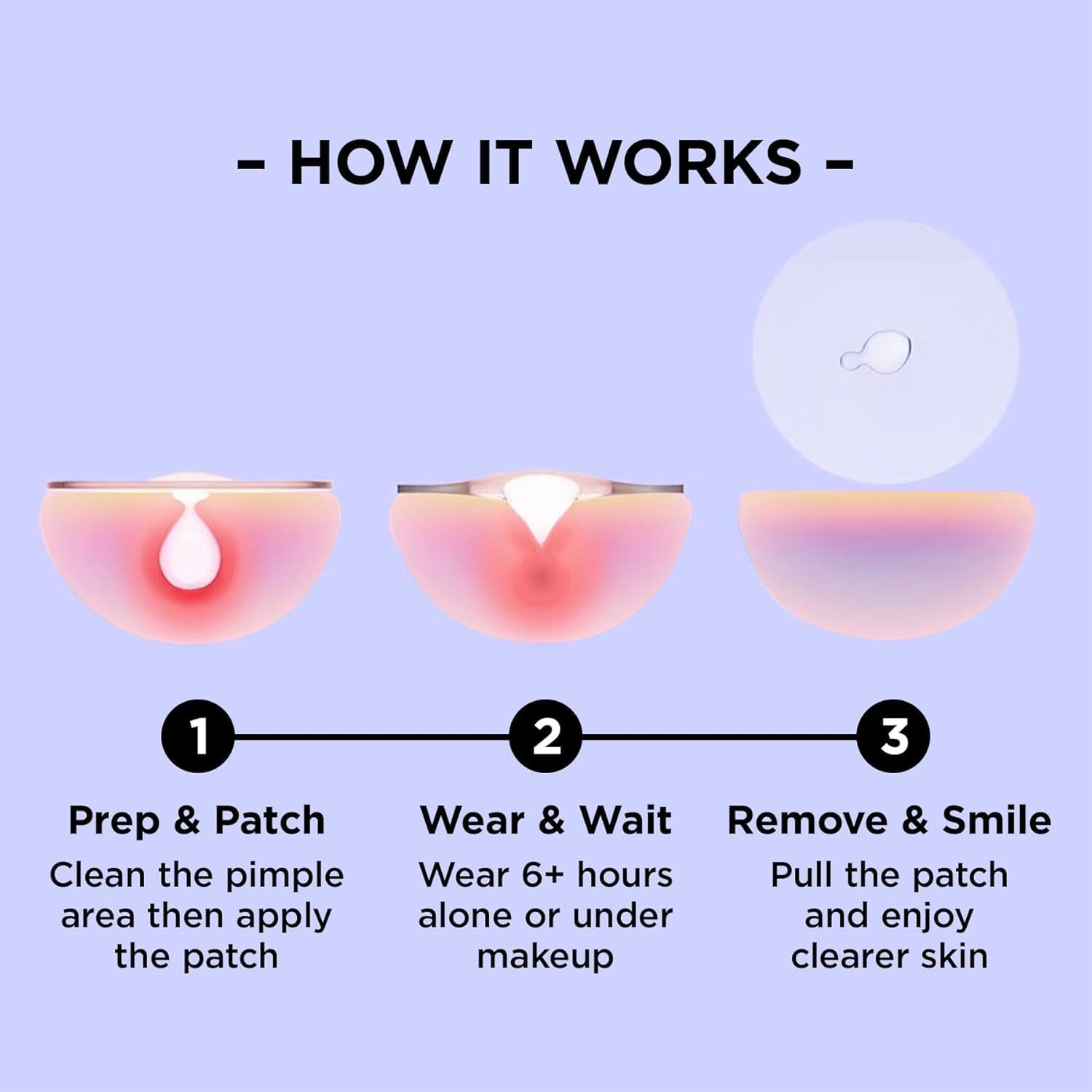 ZitSticka Pimple Patches for Face and Body, Hydrocolloid Patches to Cover Zits & Blemishes, Acne Patches or Zit Spot Stickers, Body Blemish Patch (UNDERCOVER INVISIBLE 36 Pack)