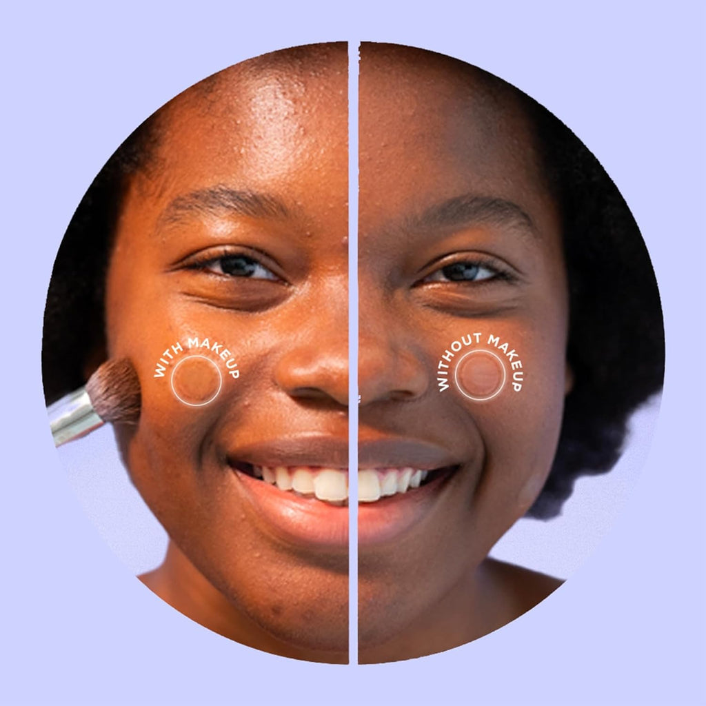 ZitSticka Pimple Patches for Face and Body, Hydrocolloid Patches to Cover Zits & Blemishes, Acne Patches or Zit Spot Stickers, Body Blemish Patch (UNDERCOVER INVISIBLE 36 Pack)